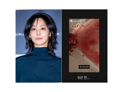 차주영 5년 전 출혈 사고로 활동 중단 이유 재조명